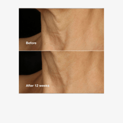 Clinique Smart Clinical Repair Lifting Face + Neck Cream